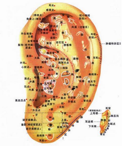耳穴压豆